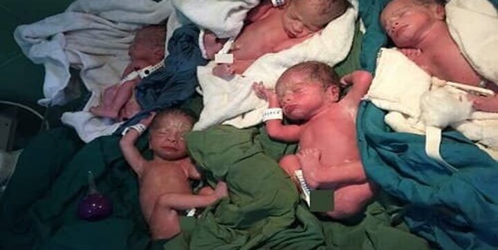تولد پنج‌قلوها در بیمارستان زینبیه شیراز
