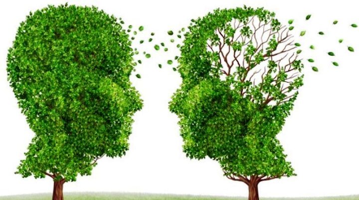 تشخیص آلزایمر با تکنیک جدید در تصویربرداری مغزی