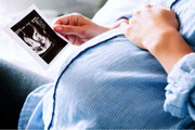 احتمال مرده‌زایی در زنان باردار مبتلا به کووید-۱۹ بیشتر است
