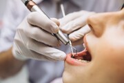 ارائه خدمات دندانپزشکی با رعایت پروتکل‌ها