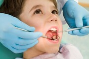 طرح بهداشت دهان و دندان برای کودکان معلول اجرا می‌شود