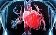 بیماری‌های قلبی عروقی، اولین علت مرگ در دنیا و ایران