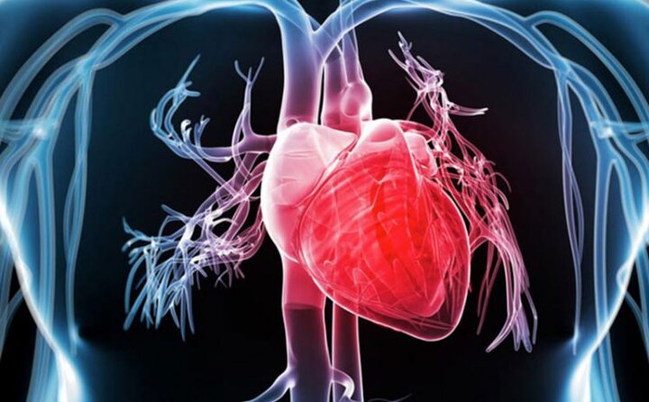 بیماری‌های قلبی عروقی، اولین علت مرگ در دنیا و ایران