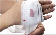 صادرات بندآورنده خون‌ریزی ایرانی به ۱۵ کشور