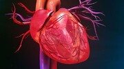 علایم سکته قلبی کدام است و چه باید کرد