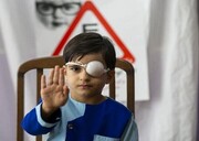 تنبلی چشم شایع‌ترین مشکل بینایی در کودکان