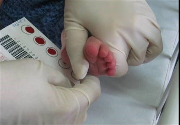 کمبود و گرانی تجهیزات نمونه‌گیری از پاشنه پا نوزادان