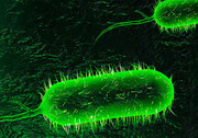 فعلا طغیانی از بیماری وبا در کشور گزارش نشده است