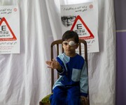 بیش از ۶۱ هزار کودک در استان بوشهر زیر پوشش طرح تنبلی چشم قرار می‌گیرند