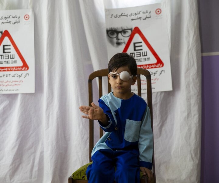 بیش از ۶۱ هزار کودک در استان بوشهر زیر پوشش طرح تنبلی چشم قرار می‌گیرند