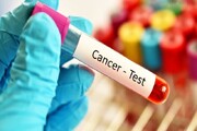 تغییری در پوشش بیمه‌ای آزمایش‌های سرطان HPV ایجاد نشده است