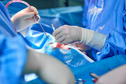 انجام بیش از  ۱۶ هزار عمل جراحی در بیمارستان‌های تامین اجتماعی استان مرکزی
